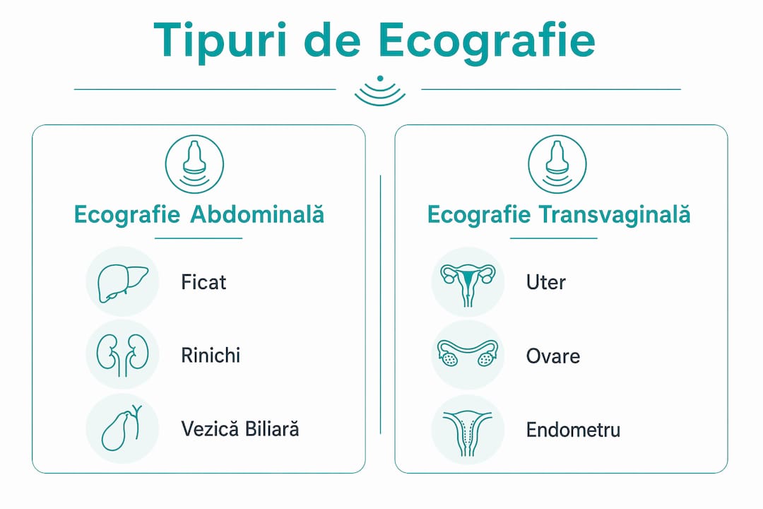 Infografic: diferențele dintre principalele tipuri de ecografie