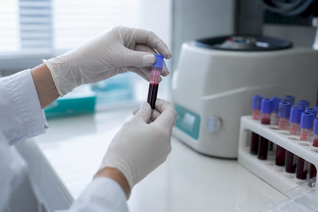 Probă de sânge pentru analiza ADN prenatală
