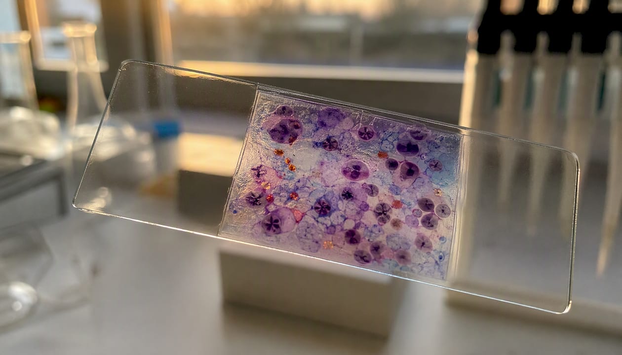 Microscope slide showing protein aggregates
