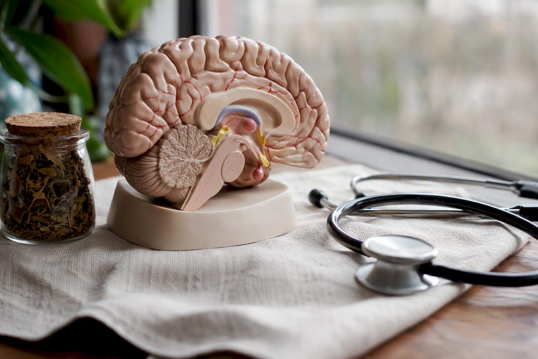 Anatomical brain model highlighting stress areas