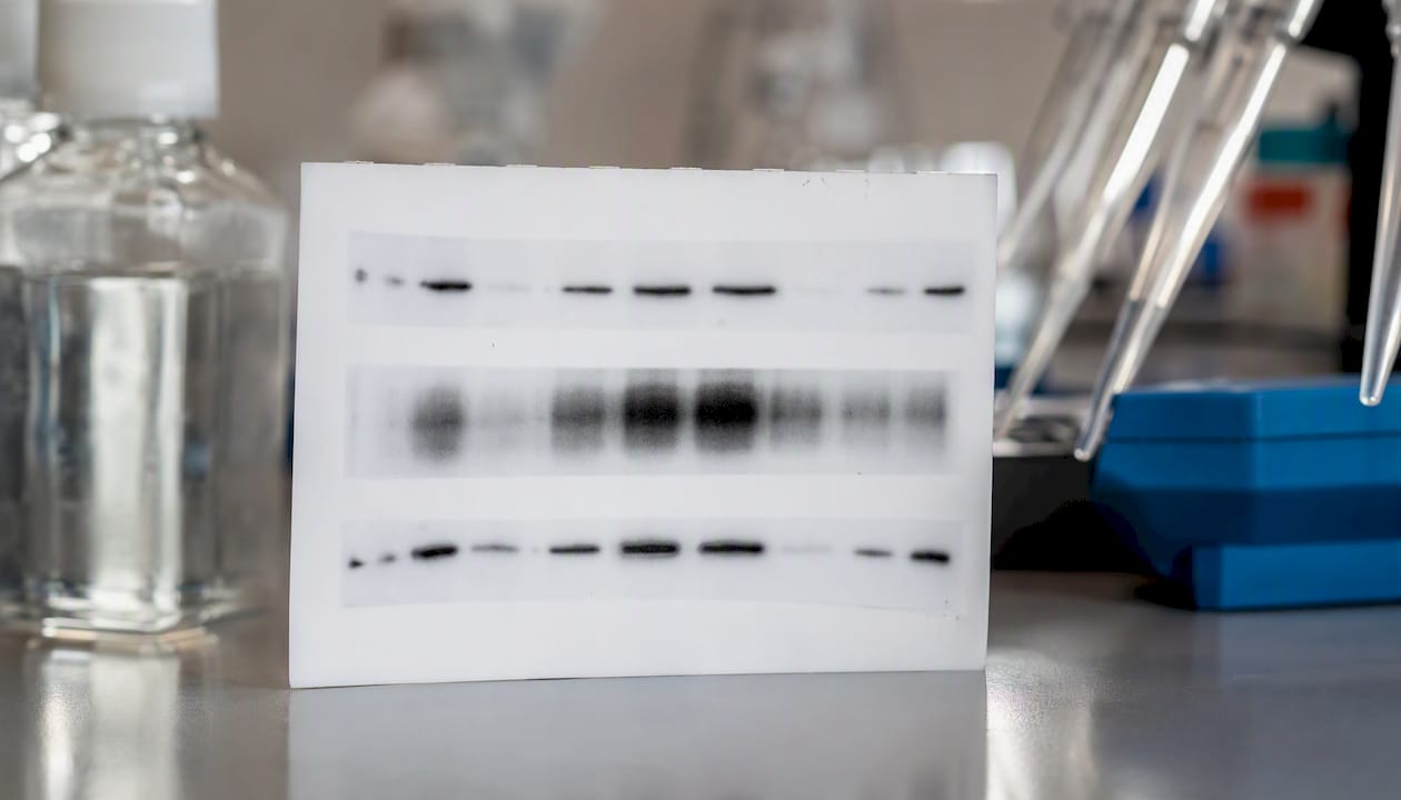 Western blot membrane with tetraspanin protein bands