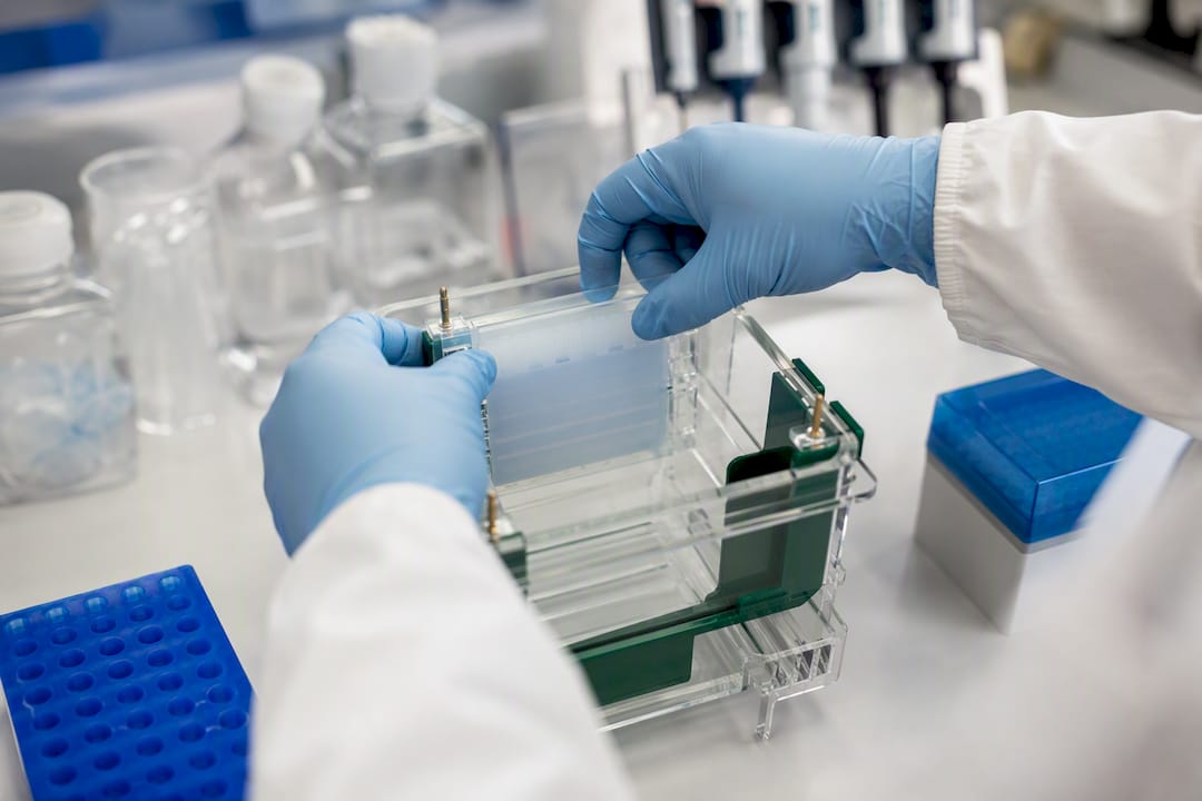 Hands setting up western blot for antibody test