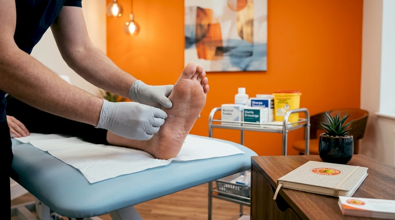 Hands applying dry needling on foot