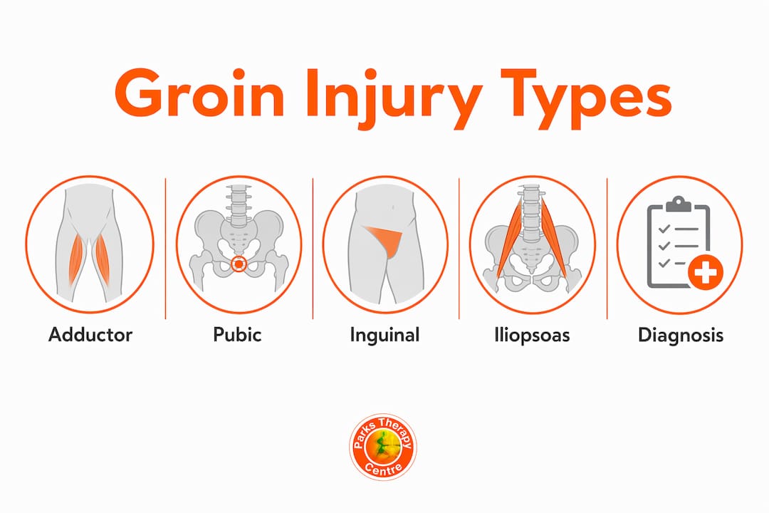 Infographic illustrating four main types of sports-related groin injuries