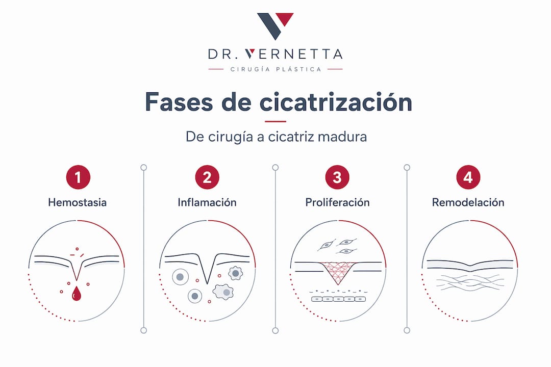 Infografía vertical que muestra las distintas etapas del proceso de cicatrización