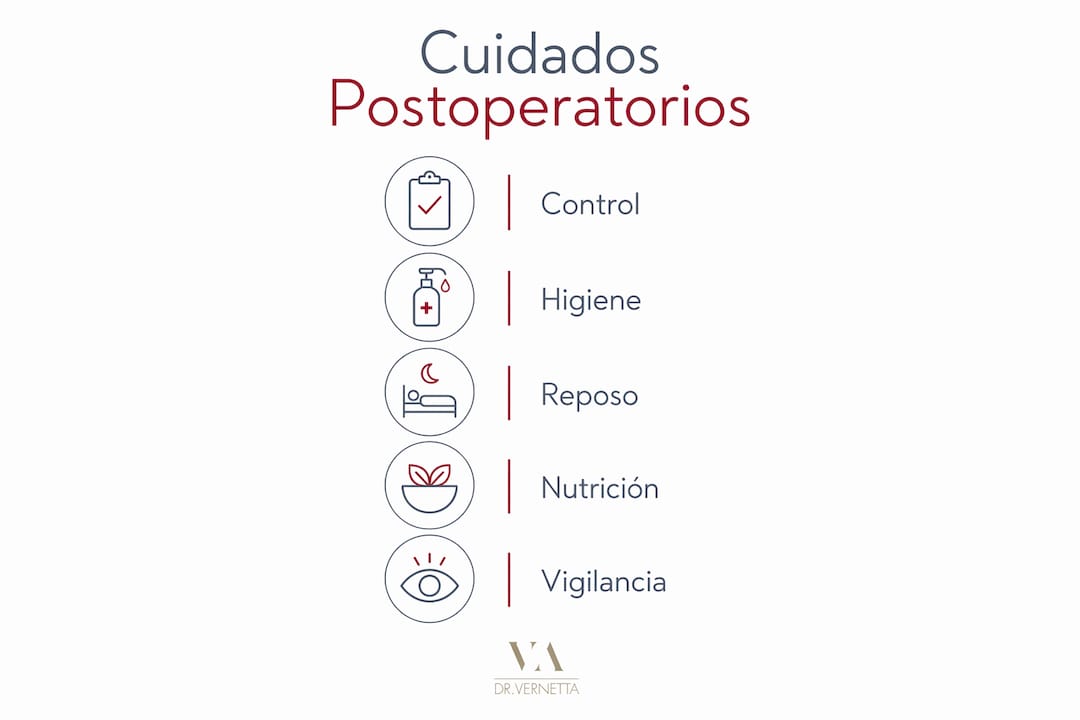 Infografía vertical con los pasos clave para un buen postoperatorio