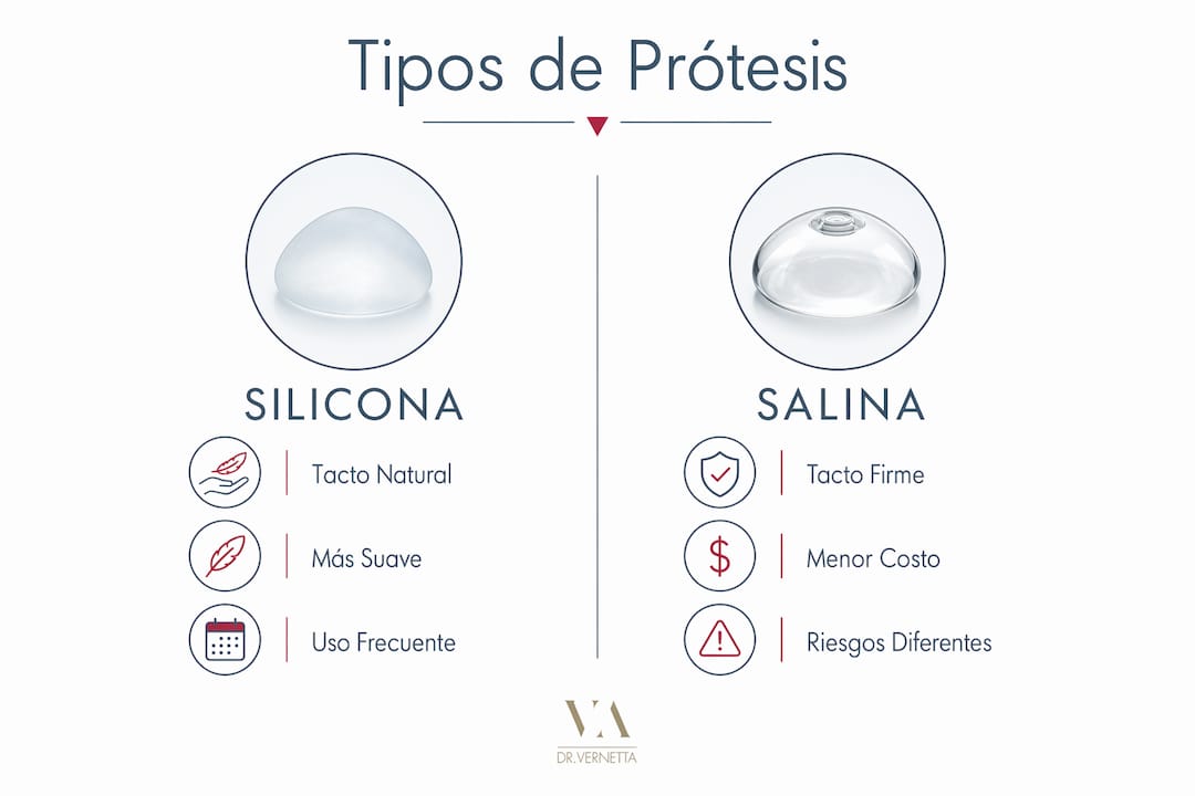 Infografía: diferencias clave entre implantes mamarios de silicona y de suero fisiológico