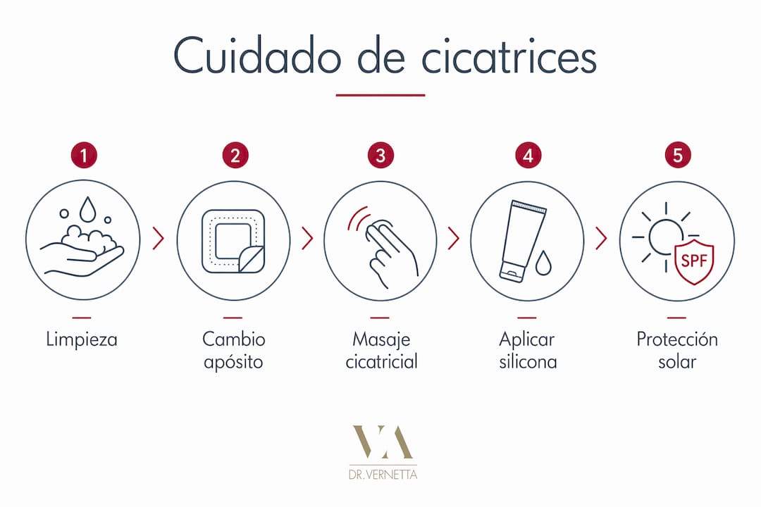 Infografía con recomendaciones y pasos prácticos para cuidar adecuadamente tus cicatrices