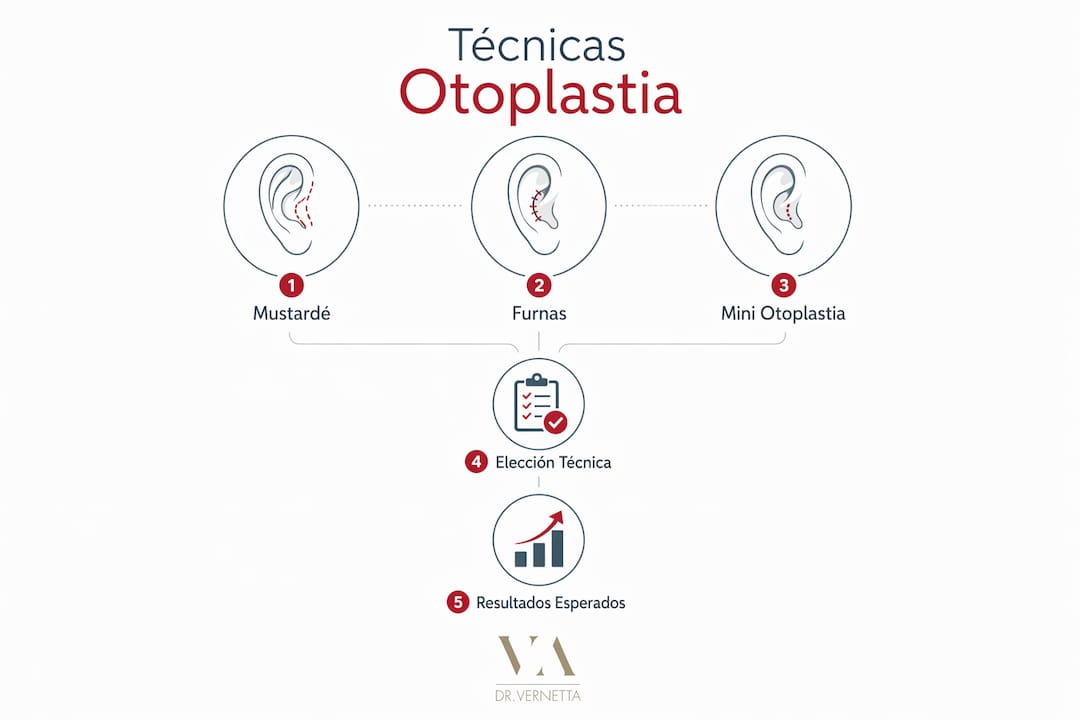 Guía visual sobre los principales métodos quirúrgicos para corregir las orejas