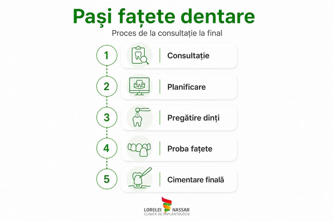 Infografic: etapele esențiale ale aplicării fațetelor dentare