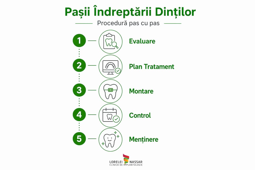 Infografic: etapele principale ale corectării poziției dinților
