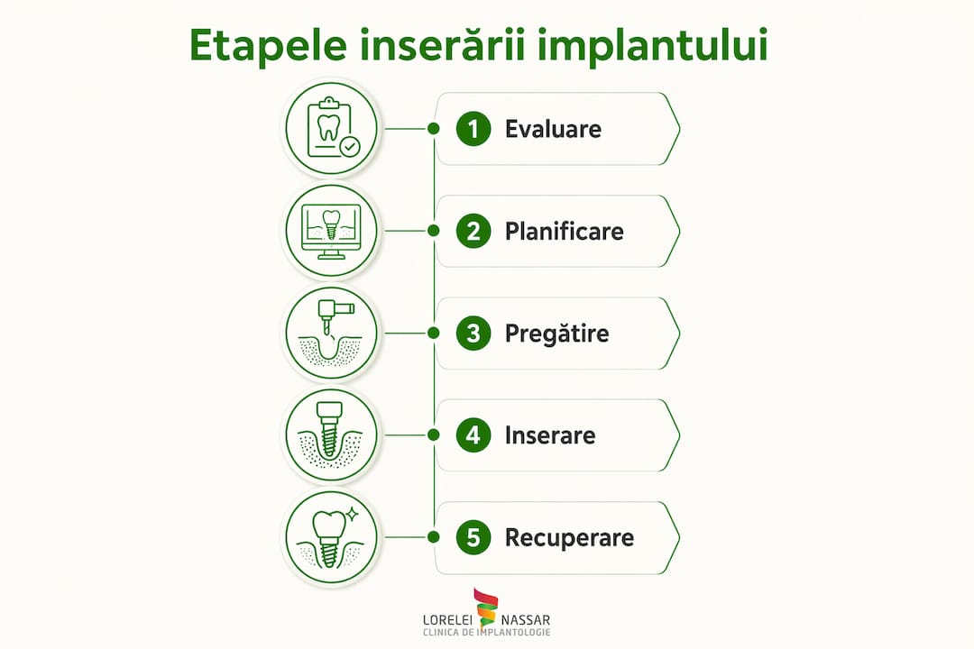 Infografic: pașii principali în procesul de inserare a unui implant dentar