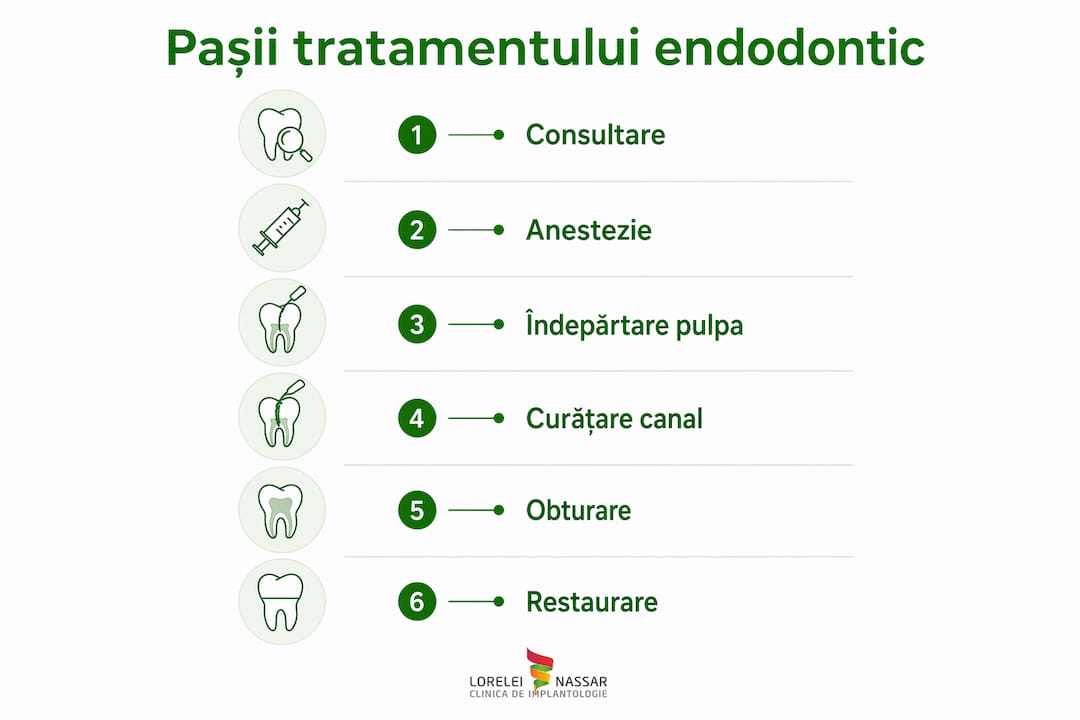 Când ai nevoie de endodonție: semne și simptome clare 2 Infografic: etapele tratamentului de canal