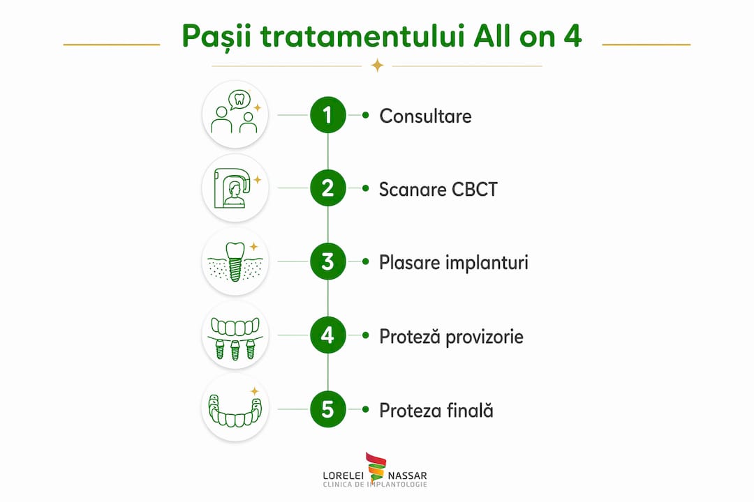 All on 4: ghid complet pentru implanturi dentare 2026 2 Infografic: etapele tratamentului All on 4
