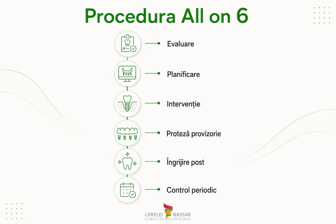 All on 6: ghid complet pentru implanturi dentare în 2026 2 Infografic: etapele tratamentului All on 6