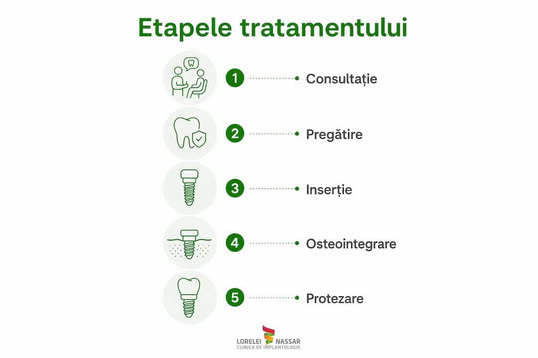 Infografic: pașii de urmat pentru un implant dentar reușit