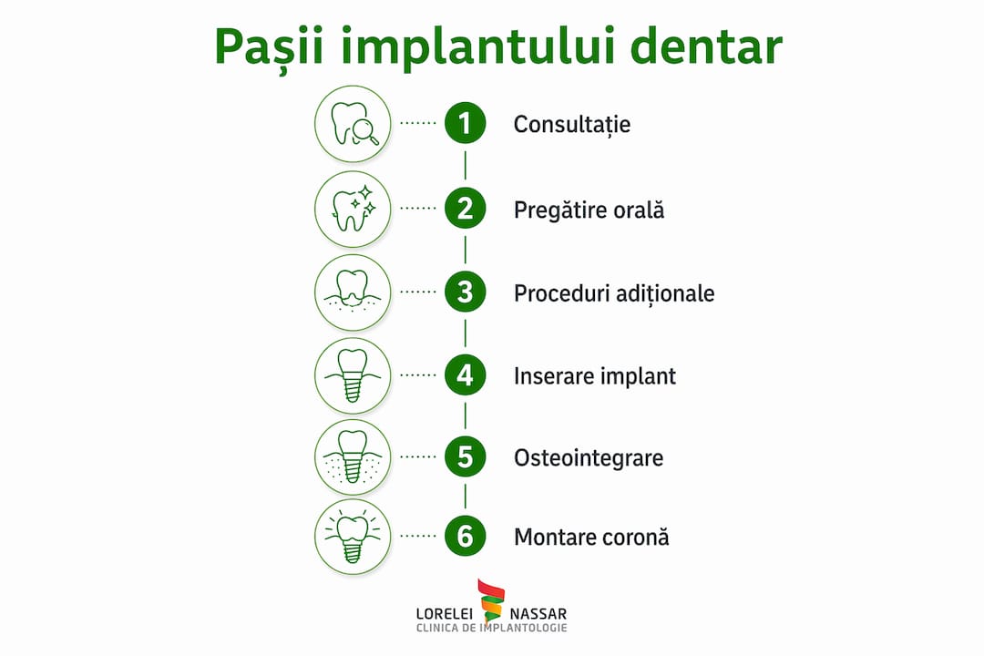 Pașii implantului dentar: ghid complet 2026 2 Ghid vizual: pașii esențiali ai procedurii de implant dentar