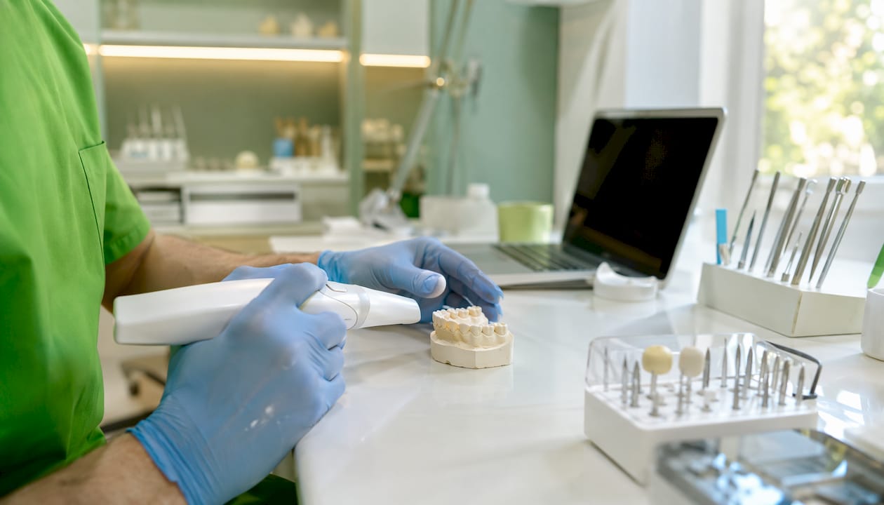 Pași pentru implant dentar fără durere: ghid complet 2 Utilizarea scannerului intraoral în cadrul laboratorului de tehnică dentară