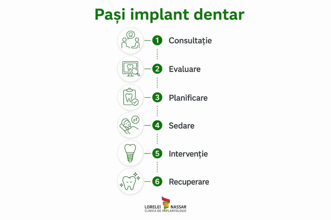 Pași pentru implant dentar fără durere: ghid complet 3 Infografic: etapele intervenției de implant dentar