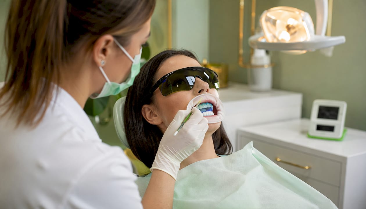 Lista opțiunilor de estetică dentară pentru 2026 1 Aplicarea gelului pentru albirea dinților, surprinsă în detaliu