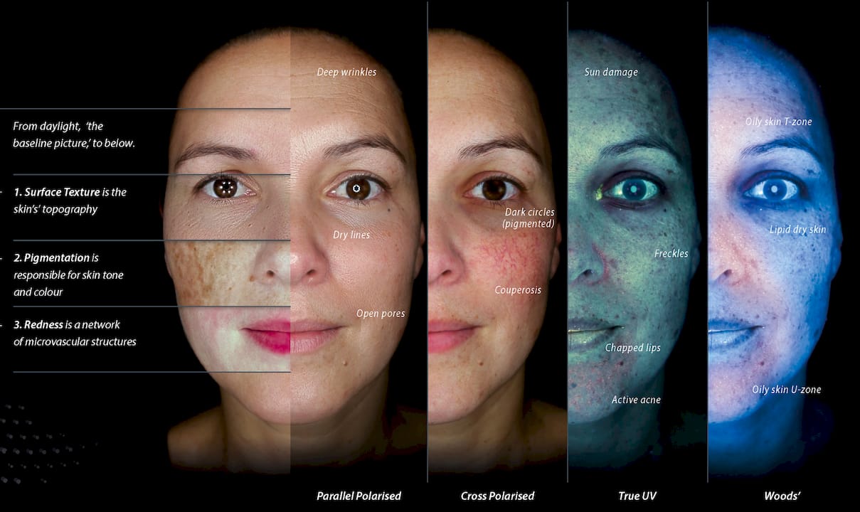 Clinician using skin analysis device on client