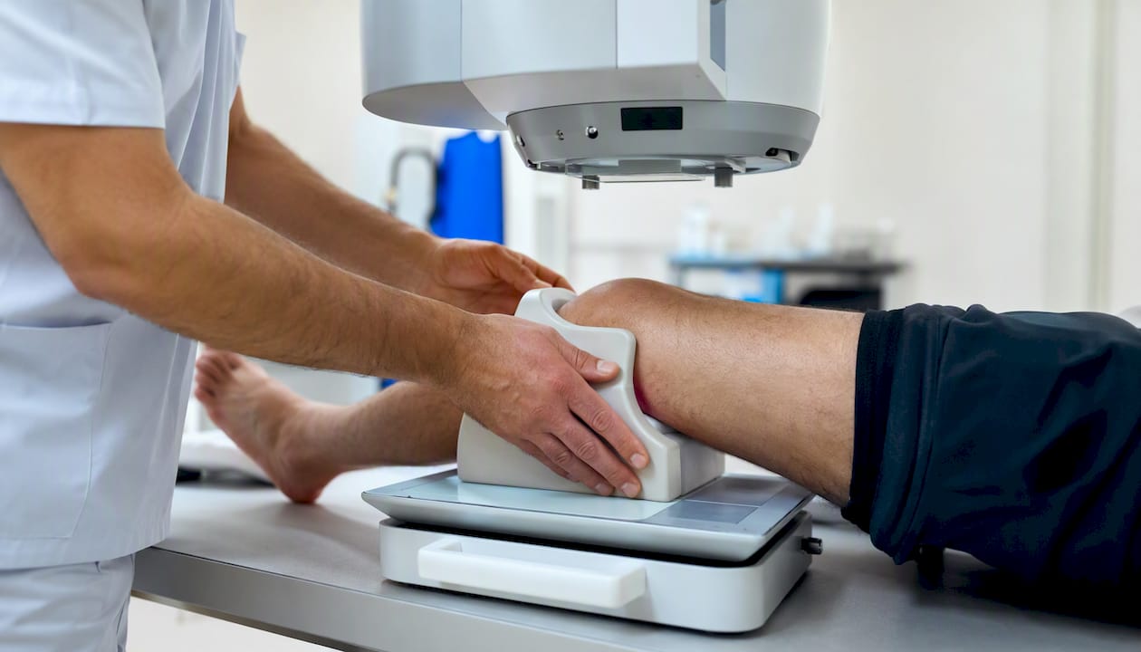 La macchina per radiografie si sta preparando per eseguire una scansione al ginocchio.