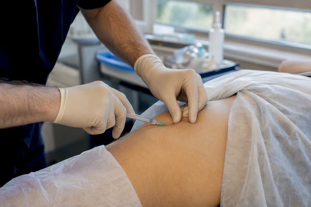 Medico che somministra un'iniezione di corticosteroidi all'anca