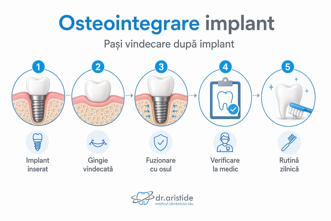 Infografic: etapele prin care trece un implant dentar pentru a se integra în os