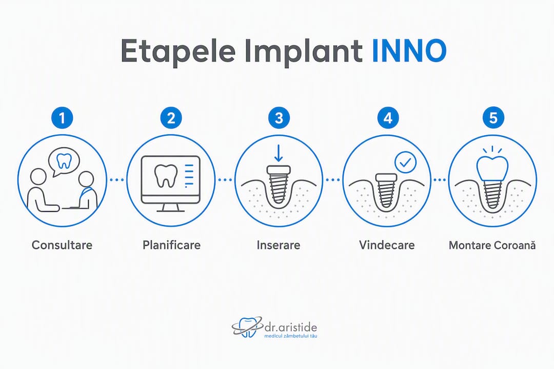 Infografic: pașii esențiali ai tratamentului cu implanturi INNO
