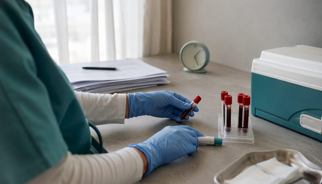 Hands preparing blood sample for nutrient test
