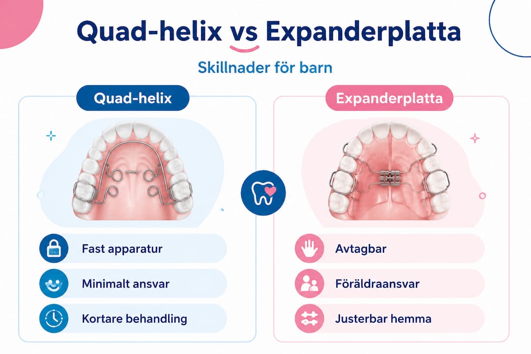 Jämförelse mellan quad-helix och expanderplatta – en överskådlig infografik