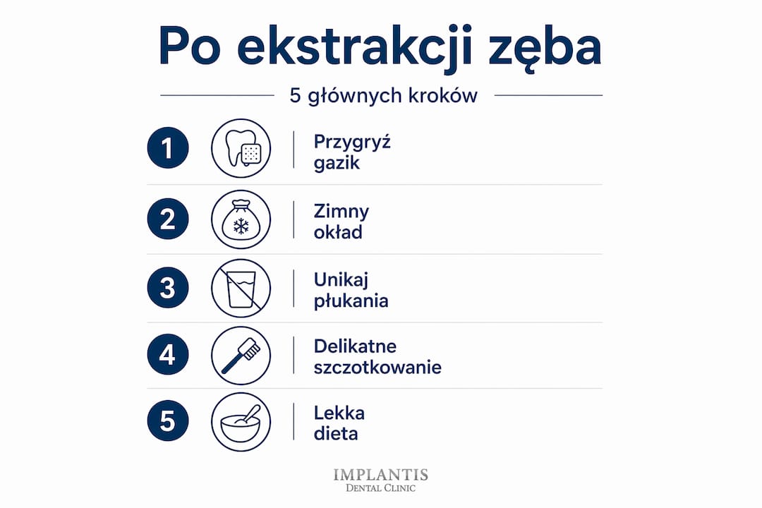 Grafika pokazująca 5 najważniejszych rzeczy, o których warto pamiętać po usunięciu zęba