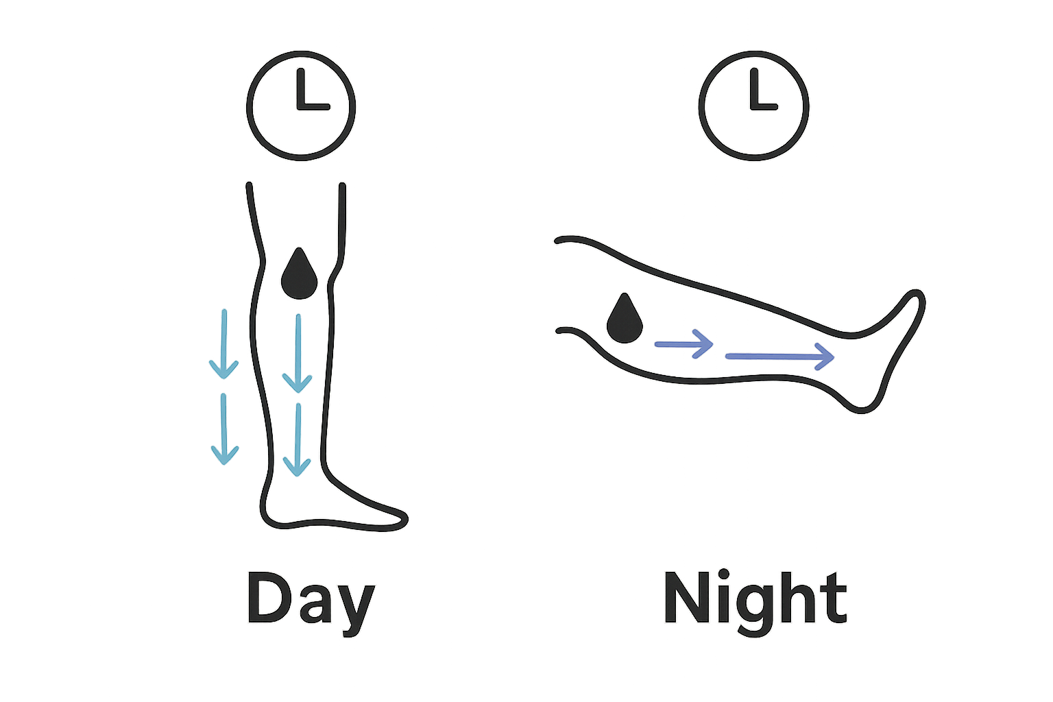 Visual comparison of fluid in legs during day and night