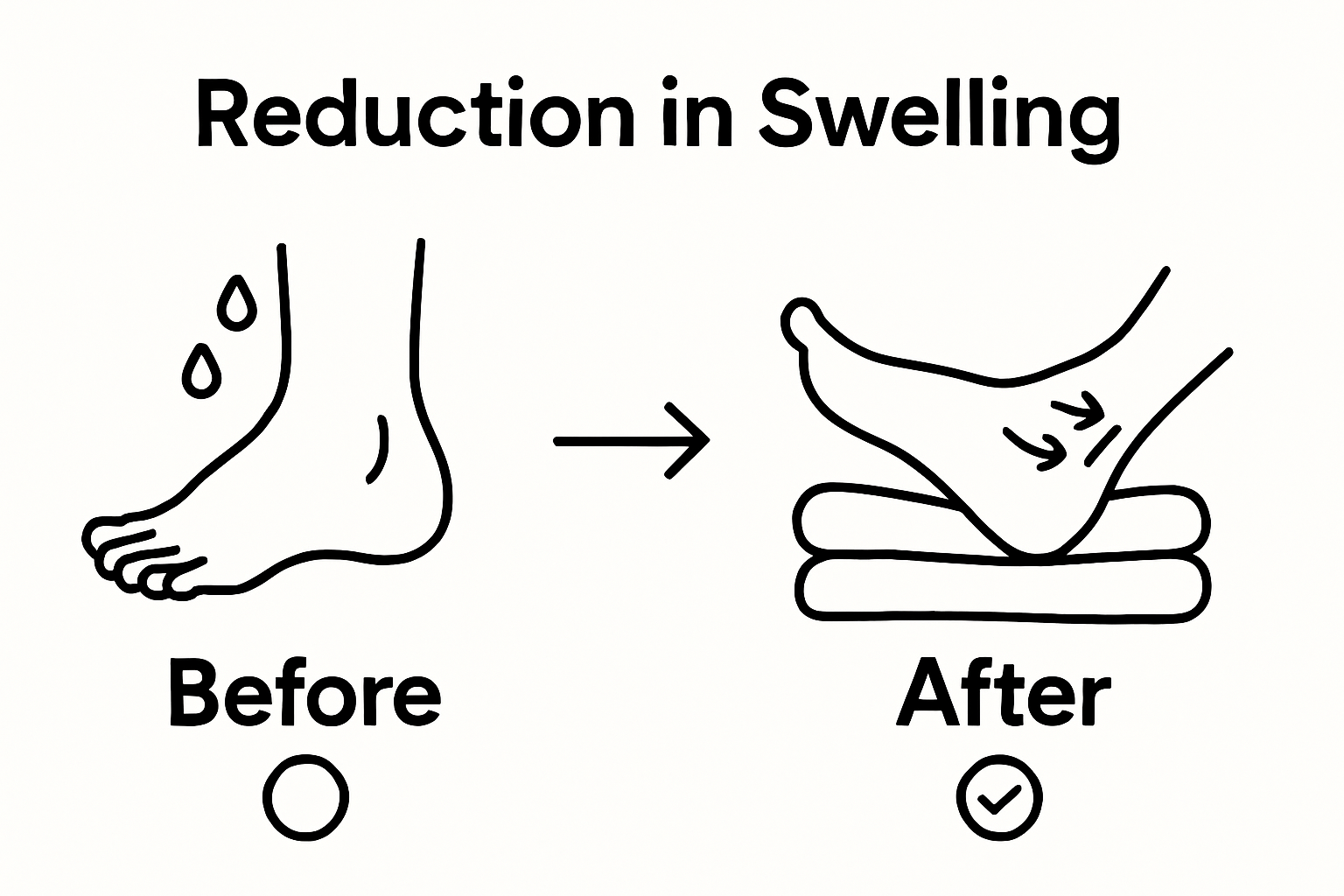 Simple comparison of foot before and after elevation for swelling reduction