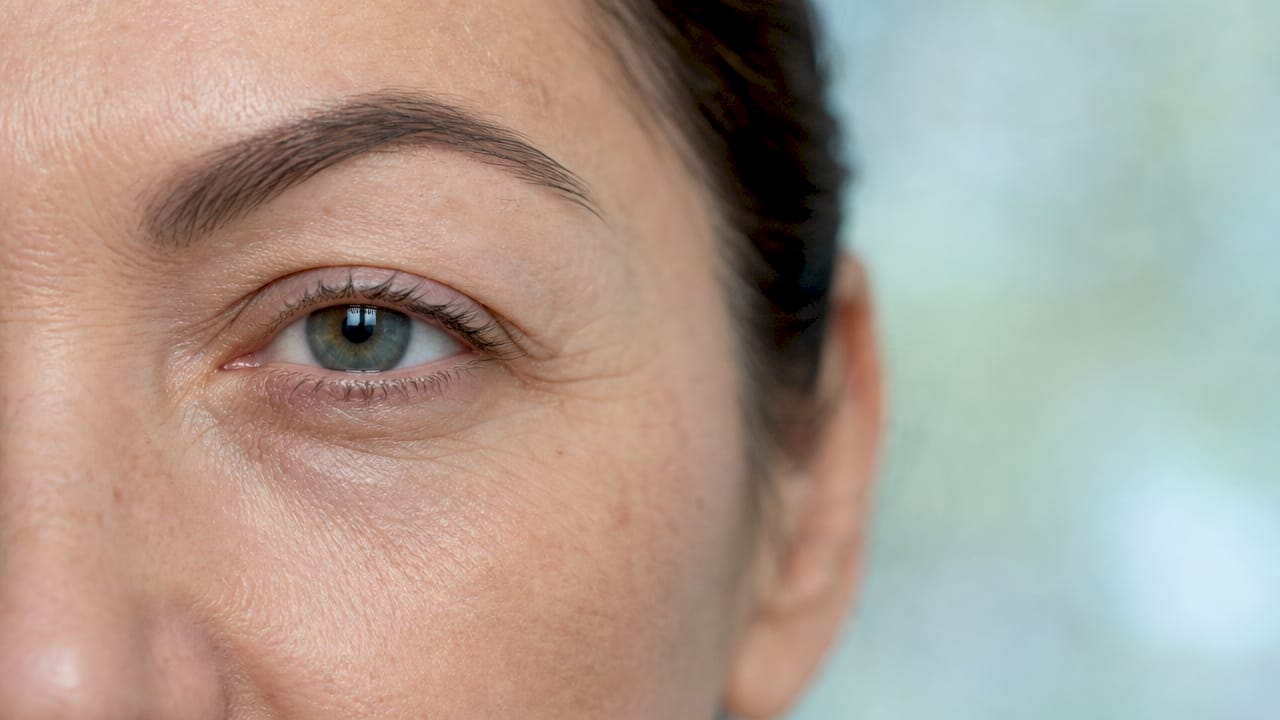 Close-up of delicate skin around eye