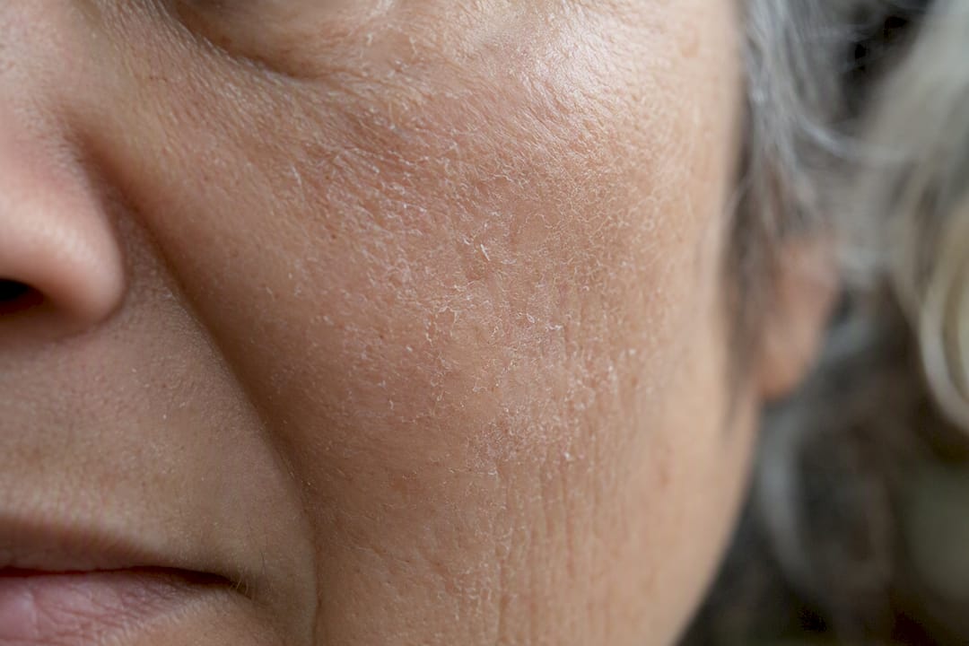Close-up of dry mature skin in winter