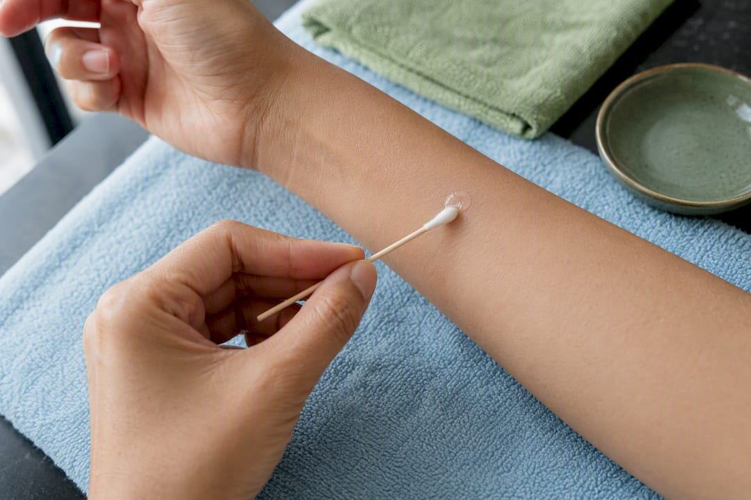 Small skincare patch test on forearm