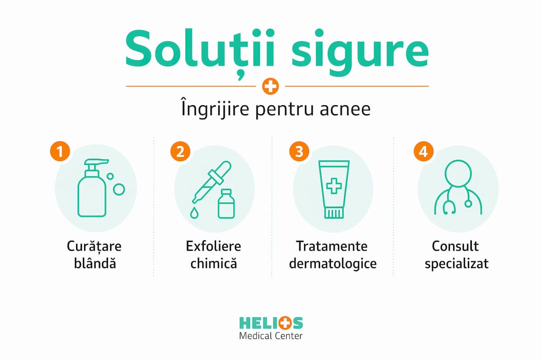 Infografic: cum să ai grijă corect de tenul cu acnee, pas cu pas