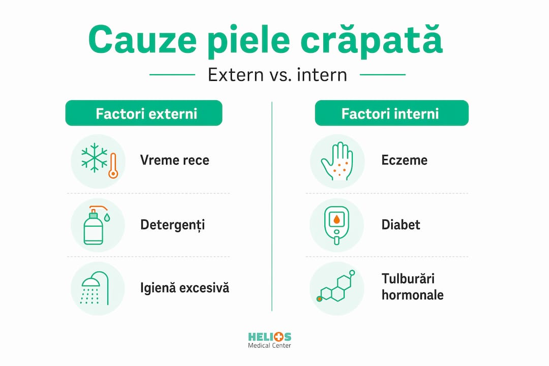 Infografic: De ce ni se crapă pielea – factori interni și externi