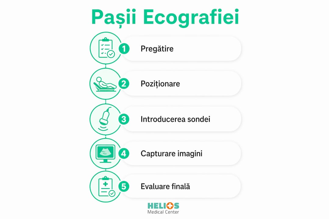 Infografic: etapele unei ecografii transvaginale