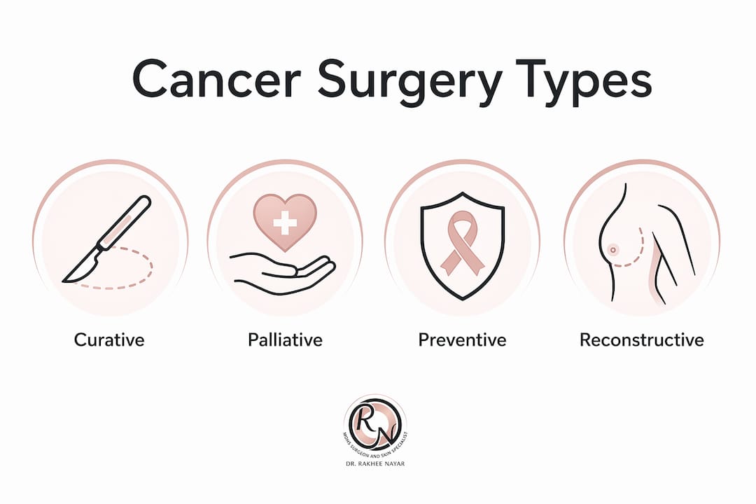 Infographic displaying types of cancer surgery