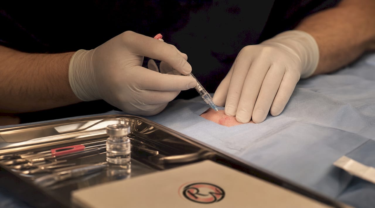 Surgeon's hands injecting local anesthetic in delicate skin