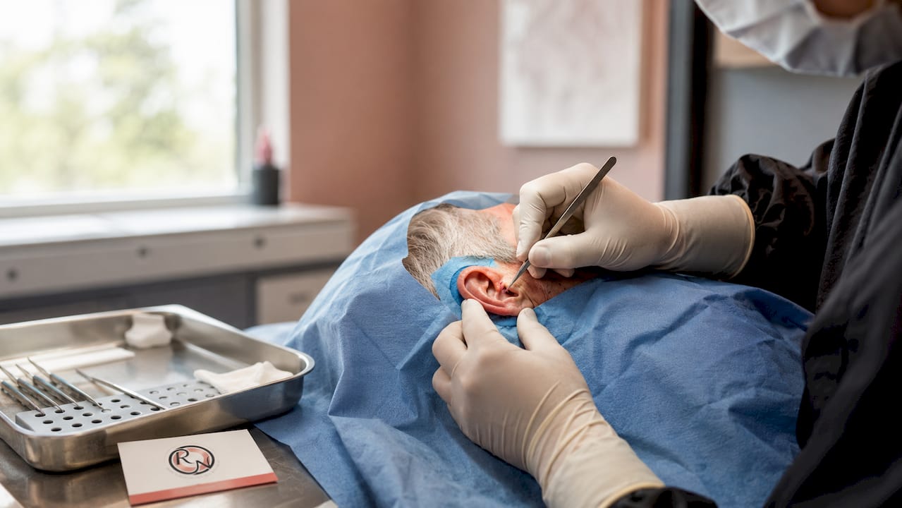 Close-up of Mohs surgery on ear being performed