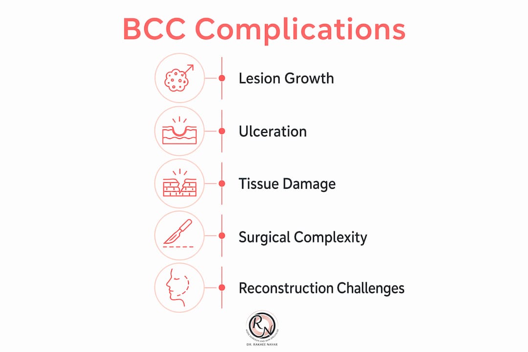 Infographic outlining complications of untreated basal cell carcinoma