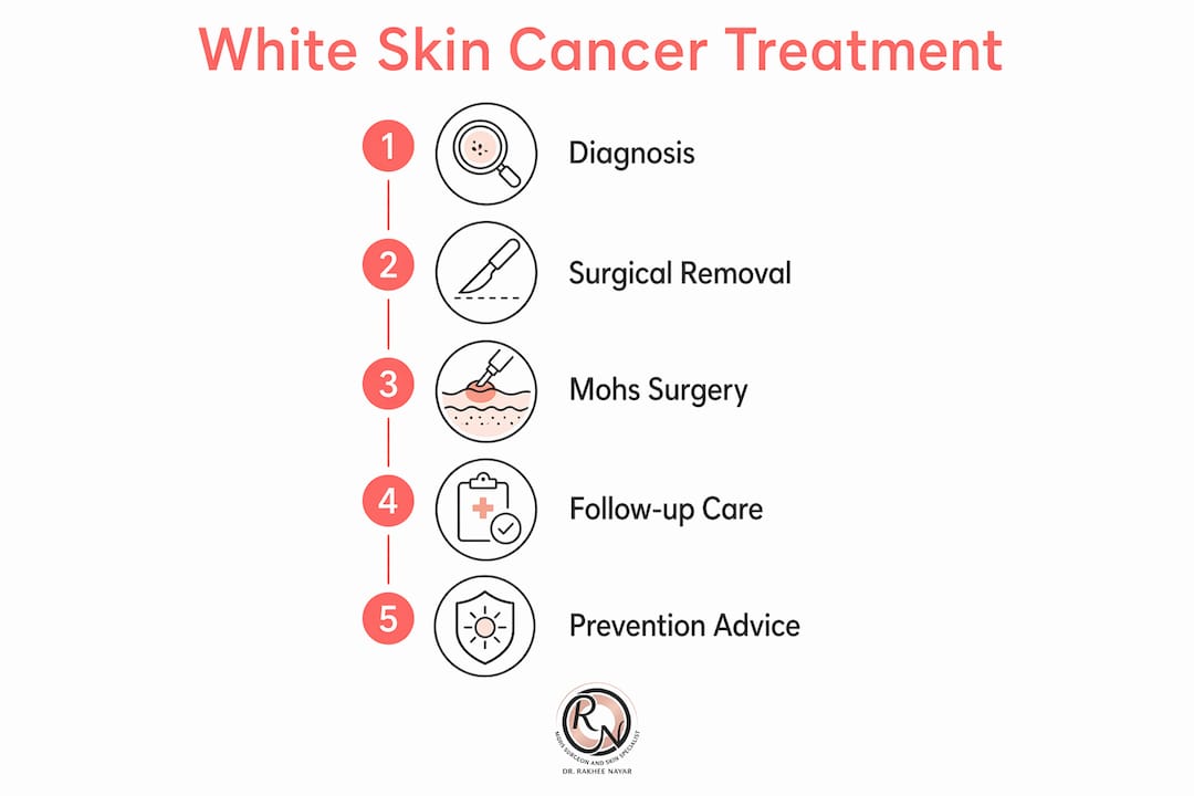 Infographic detailing white skin cancer treatment steps