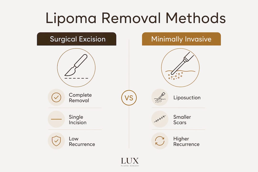 Infographic comparing lipoma removal techniques