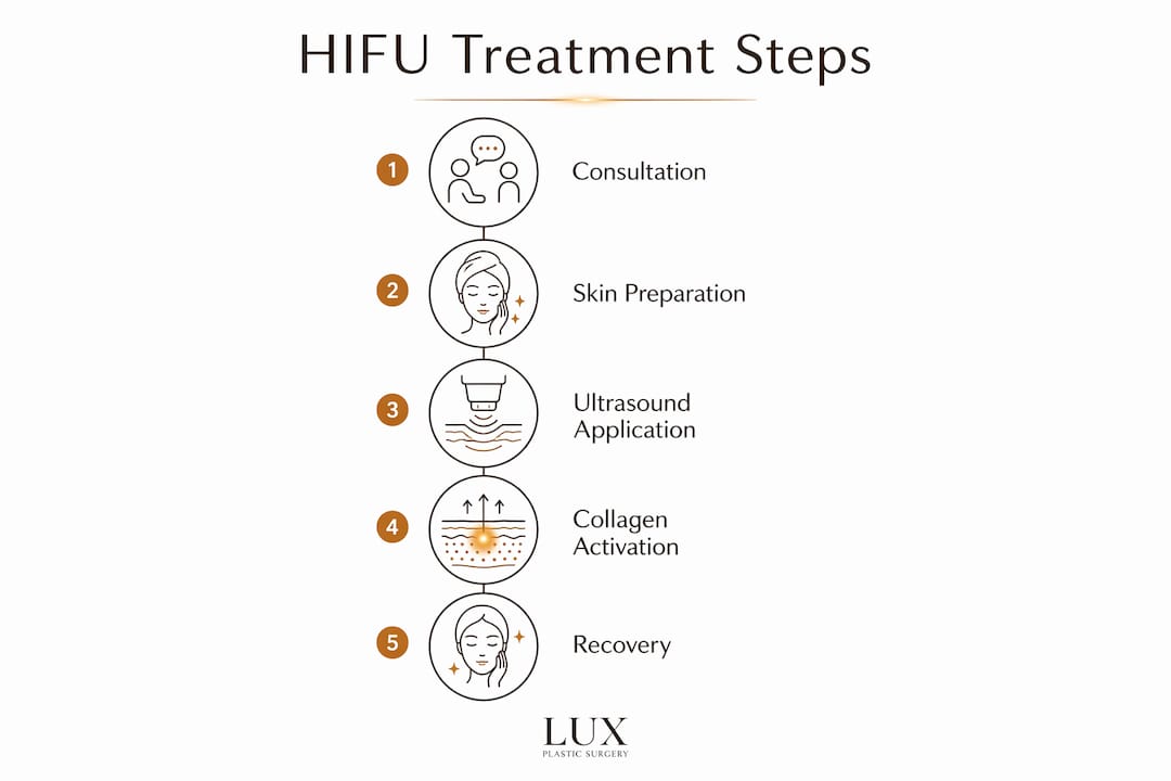 Infographic illustrating five key HIFU treatment steps