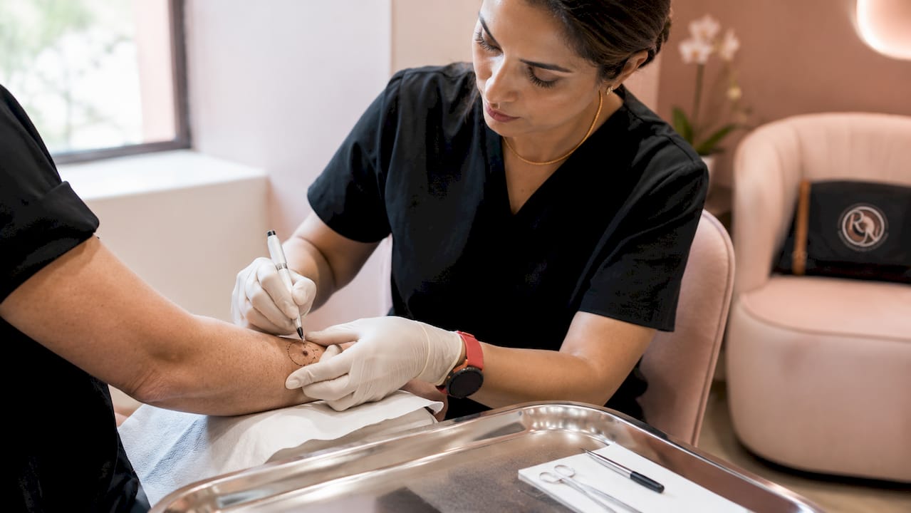 Surgeon marking skin cancer excision margins on arm