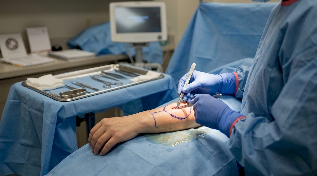 Surgeon's hands performing excision surgery