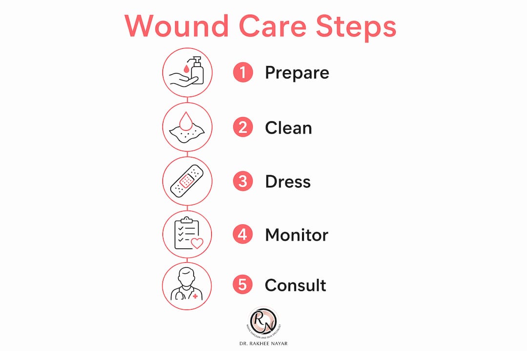 Infographic illustrating post-surgery wound care steps